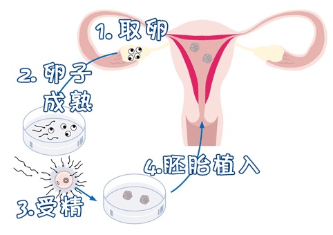 42岁成功案例